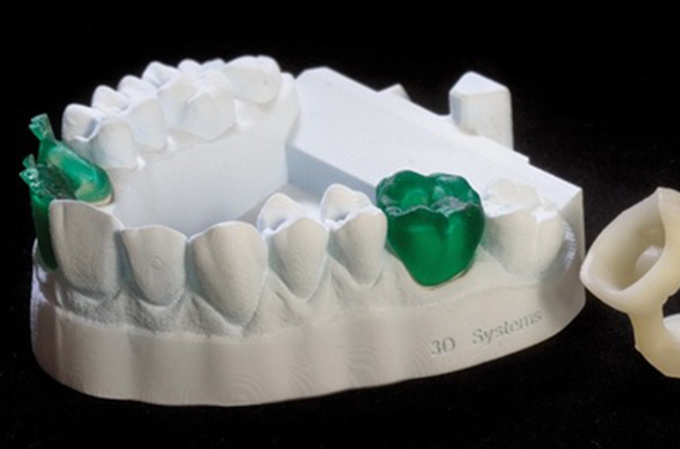 德國(guó)率先引入3D打印牙齒技術(shù) 全程體驗(yàn)“無痛”種牙-e鍵打印|3D打印服務(wù)
3d打印牙齒,3D打印種牙,無痛種牙,3D打印平臺(tái),3D打印服務(wù),南京哪里有3D打印,南京3D打印廠家,南京3D打印服務(wù)